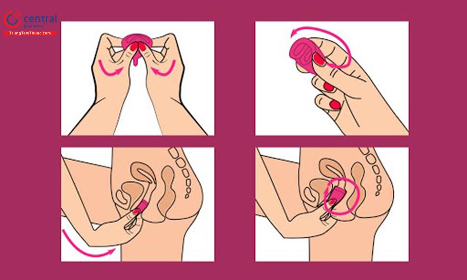Hướng dẫn đặt cốc nguyệt san đúng cách