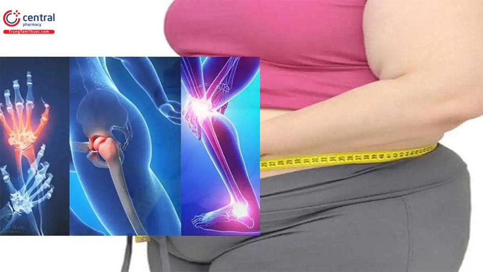 Béo phì có thể dẫn đến viêm khớp