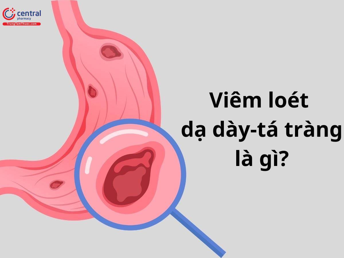 Viêm loét dạ dày - tá tràng là gì